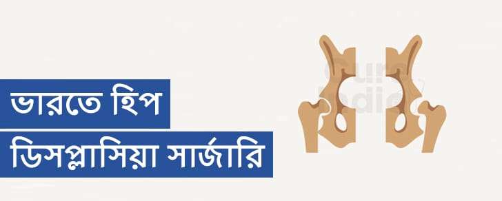হিপ ডিসপ্লেসিয়া